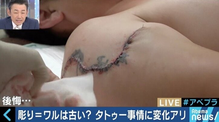 風当たりの厳しさにイベントを中止、除去手術を決断する人も…ガラパゴスな日本のタトゥー事情