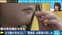自分の髪の毛を食べてしまう女性に聞く“異食症”の実態