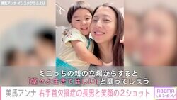 ロッテ・美馬学投手の妻アンナ、右手首欠損症の長男と笑顔の2ショット「堂々と生きてほしい」