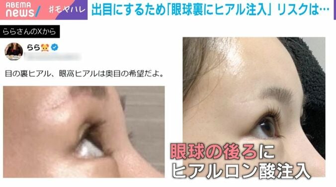 ららさん