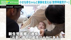 「小さく生まれた赤ちゃんでも…」“早産児”支える日本の周産期医療 「世界早産児デー」