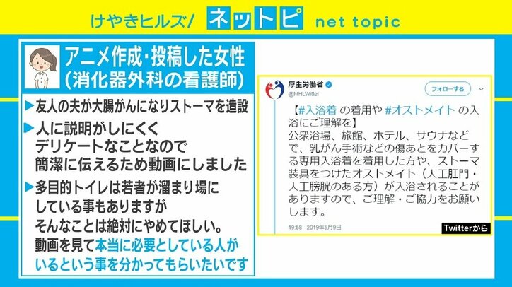 「ストーマ」「オストメイト」に理解を 「わかりやすい」説明動画が話題