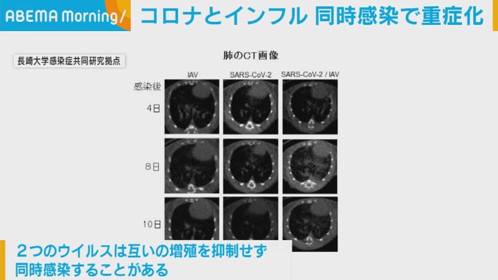 コロナとインフル同時感染で重症化