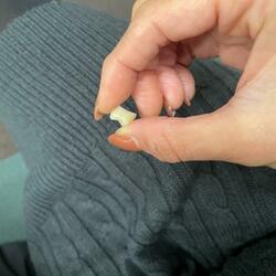  料理研究家・桜井奈々、歯科医院を訪れて“超絶仰天”した出来事「痛すぎて、、きつすぎて」 