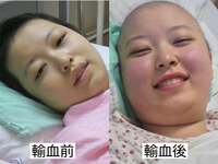 友寄蓮『輸血直後のビフォーアフター』
