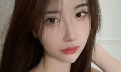 整形総額1300万円の美女、“立ち耳”整形の効果を明かす「1年で元通りになってしまったけど…」