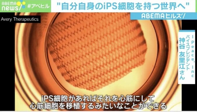 髪の再生、老化防止も…“iPS細胞”は個人が持つ時代？ 約1億円の作製費用も低コストに 1枚目