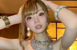 総額2000万円！全身フル整形のトランスジェンダーモデル、18歳から美容整形を続ける理由を告白
