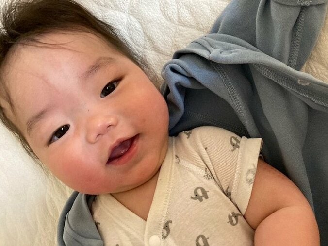 ニッチェ・江上、BCGワクチンを接種した息子の経過「だんだん腫れてきました」 1枚目