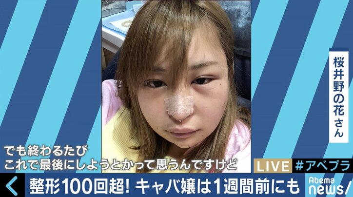 100回以上の整形手術を繰り返した歌舞伎町キャバ嬢の告白 メイク感覚・SNS社会が生んだ「整形依存」