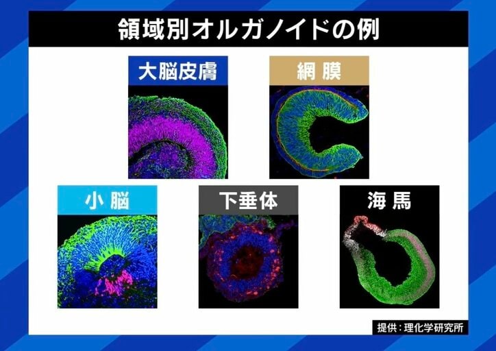 【写真・画像】 3枚目
