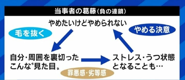 中学受験のストレスで発症してしまう小学生も…「気付いたら周りが頭髪だらけに…」やめたいのにやめられない“抜毛症”に悩み続ける女性