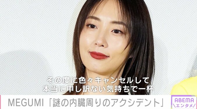 MEGUMI「謎の内臓周りのアクシデント」体調不良が頻発 1枚目