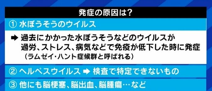 「自分の顔が自分の顔じゃなくなってしまう感じが残った」ジャスティン・ビーバーも罹患した“ラムゼイ・ハント症候群”、発症のピークは20代と50代に 7枚目