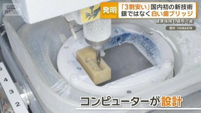 コンピューターが設計