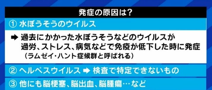「自分の顔が自分の顔じゃなくなってしまう感じが残った」ジャスティン・ビーバーも罹患した“ラムゼイ・ハント症候群”、発症のピークは20代と50代に