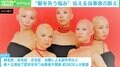 「髪がない=かわいそうではない 」30年隠してきた“抜毛症”当事者の訴え