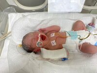 光上せあら『ご報告』