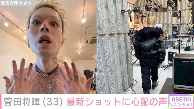 菅田将暉（33）、最新ショットに心配の声「すんごい痩せてたね」「本当に骨と皮になるほどやつれられて…」 3枚目