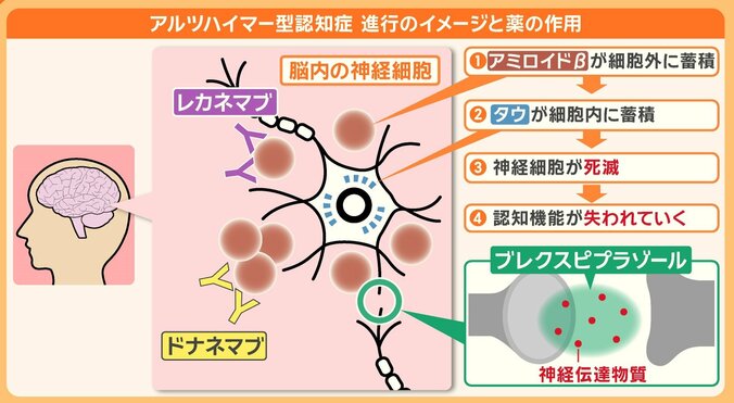 アルツハイマー型認知症の進行過程と薬の作用