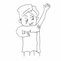 キンタロー。『デリケート部分の色素が。。』