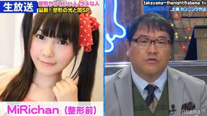 約900万円で10カ所を整形したMiRichan、実年齢にスタジオ衝撃「みえない！」