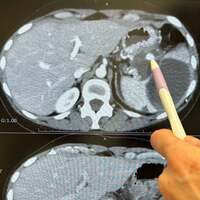 ミミポポ『【報告】明日から入院します＆大事なお知らせ』