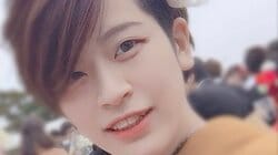 整形に500万円超かけ中洲元No.1に 28歳キャバ嬢がビフォーアフター公開「見た目を気にするように…」
