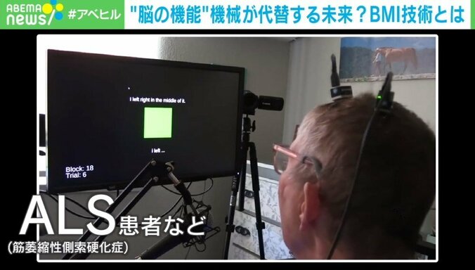 きちんと発語できなくても”脳波で文字入力”が可能に 期待高まる「BMI技術」とは 1枚目