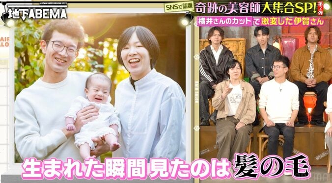 【写真・画像】何度カットしても剛毛ビフォーに戻る男、幼少期の写真に驚きの声「突然変異！」　2枚目