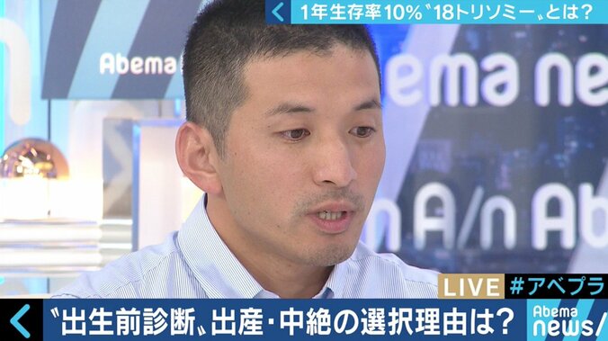“1年以上の生存率は10％”…18トリソミー児の家族たちが写真展に託した苦悩と葛藤 15枚目