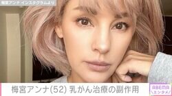乳がん闘病中の梅宮アンナ（52）、治療の副作用を明かす「毎日ロシアンルーレットですよ」