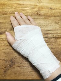 キンタロー。『手首がー』