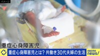 重症心身障害児とは? 24時間ケアをする共働き夫婦の日常「幸せや喜びも」