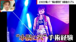 「断腸の思い」リアルに経験した女子総合格闘家「急に嘔吐」「ずっと回復しなかった」 “小腸に穴”、現在も残る手術痕