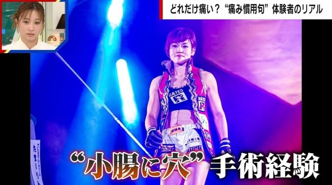 女子総合格闘家の富松恵美氏