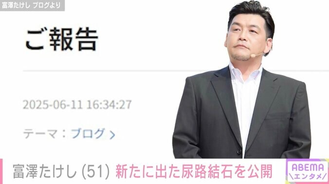 【写真・画像】サンド富澤、“恒例行事”の新たな尿路結石を公開「腰の痛みと血尿で動き始めたな」　1枚目