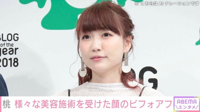 【写真・画像】“3度の二重施術”桃、目元の美容施術のビフォーアフターを公開　1枚目