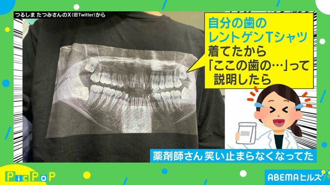 薬剤師も爆笑!! 歯の痛みを伝えるために使用した“レントゲンTシャツ”に「怖いけどわかりやすい！」「どう作るんだ」と絶賛の声 1枚目