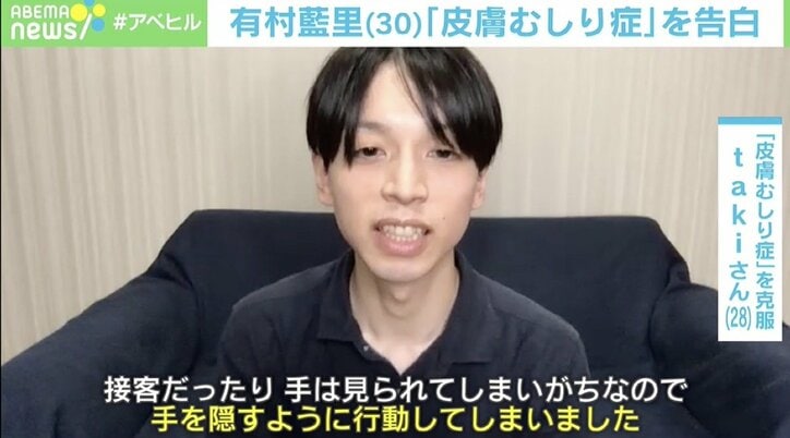 有村藍里も悩む 皮膚むしり症 6歳で発症した経験者が語る治療 3つのステップ と専門家による習慣逆転法とは 芸能 Abema Times