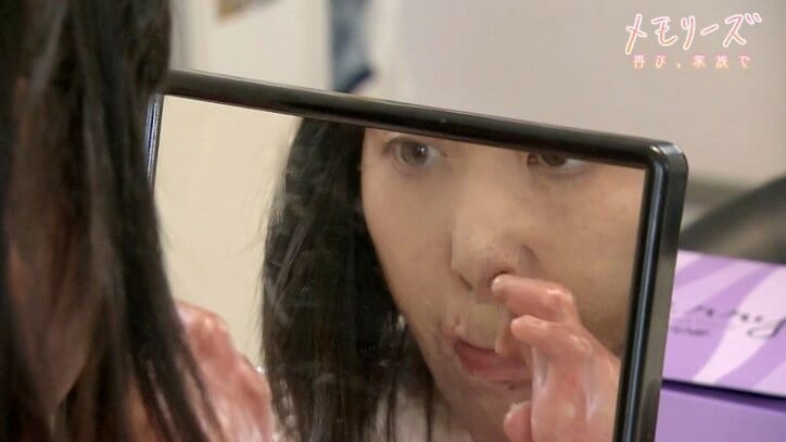 「泣いていても元には戻れない」交通事故で全身の60%に火傷を負った母、子どもたちとの距離が縮まるまで
