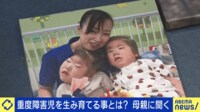 重度障害児を生み・育てる葛藤とは 母親「幸せな時間だった」心無い批判の声も