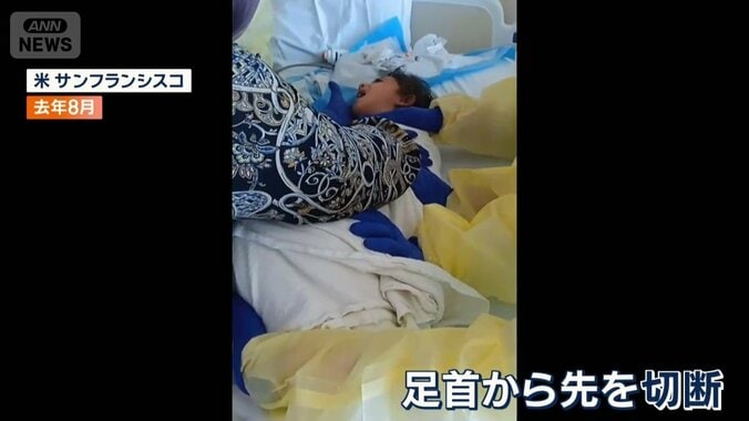 足首から先を切断するしかない状態