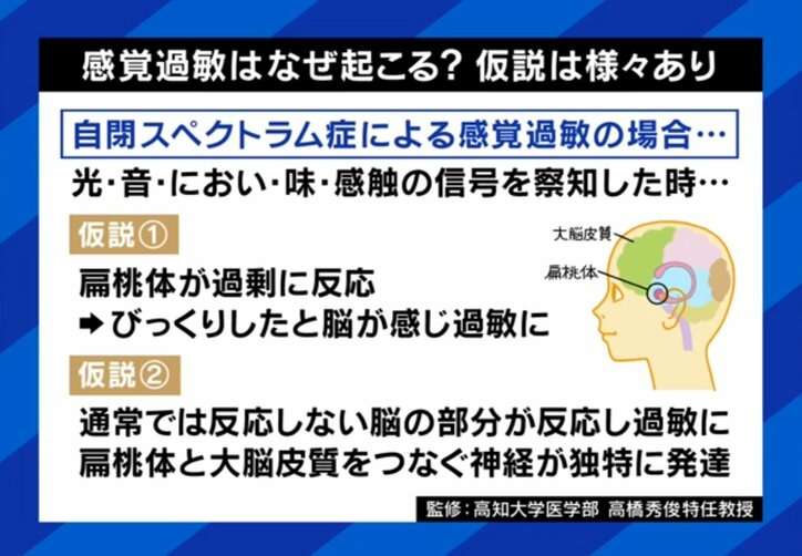 感覚過敏の仕組み