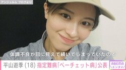アンジュルム・平山遊季（18）、指定難病“ベーチェット病”を公表「今を精一杯楽しみ頑張ります！」