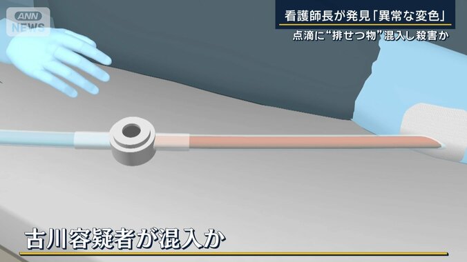 側管から患者の身体へと続く部分