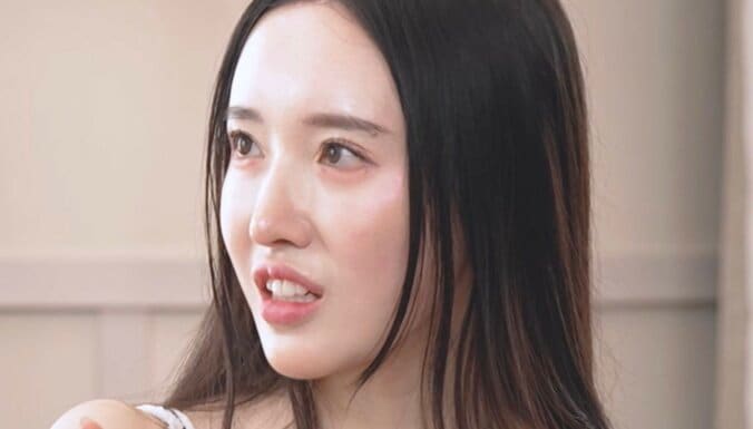 【写真・画像】24歳整形美女、“3度の目の手術”とそのダウンタイムを語る「目をつむるたびに…」　1枚目