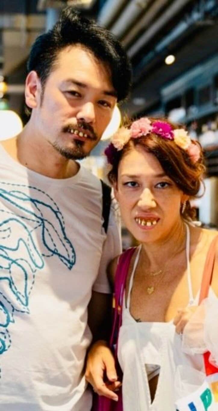 LiLiCo、夫婦で入れ歯をした写真を公開「照明が不気味に当たってるから余計に変」