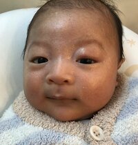 蛯原英里、息子の左目のまぶたが腫れ小児科へ「どうやら虫に刺されたみたい？」