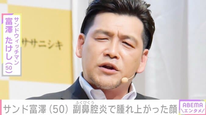 【写真・画像】サンド富澤たけし（50）、副鼻腔炎で腫れ上がった顔を公開「こんなに腫れるんですね」　1枚目